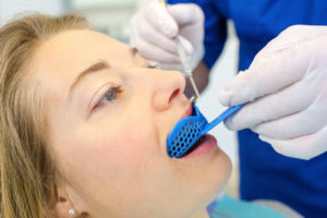 Impronte dentali carico immediato 24 ore