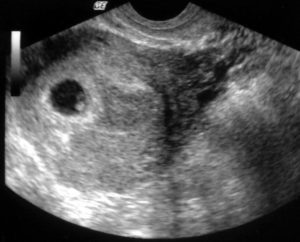 ecografie gravidanza reggio emilia
