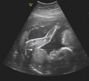 ecografia in gravidanza reggio emilia