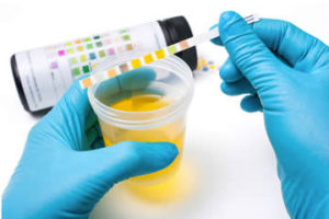 esame delle urine test dipstick